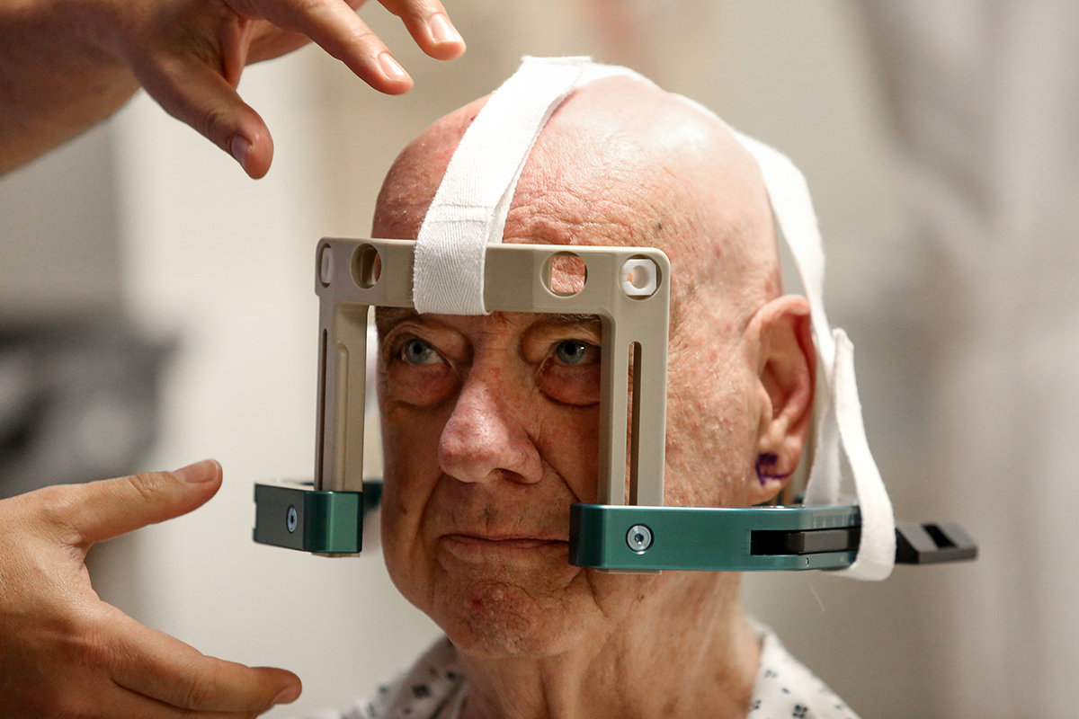 Robert Connelly undergoes preparation for his focused ultrasound procedure.